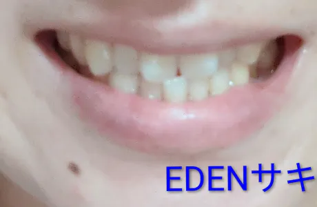 サキ(青森・弘前出勤)EDEN