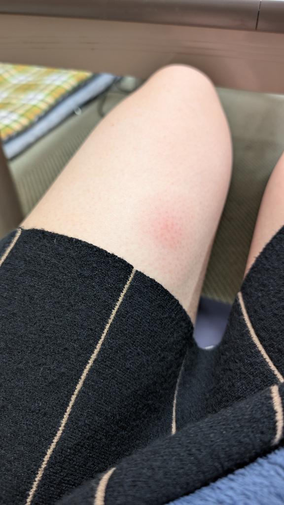 吸われちゃった…