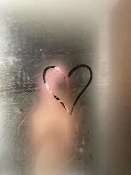 骨折からの回復🦴/あかね