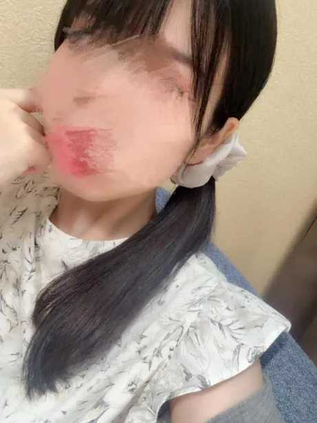 🥺