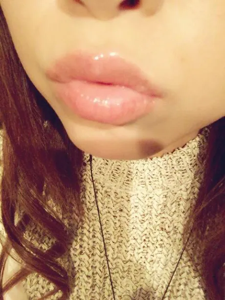 キスキスキス💋
